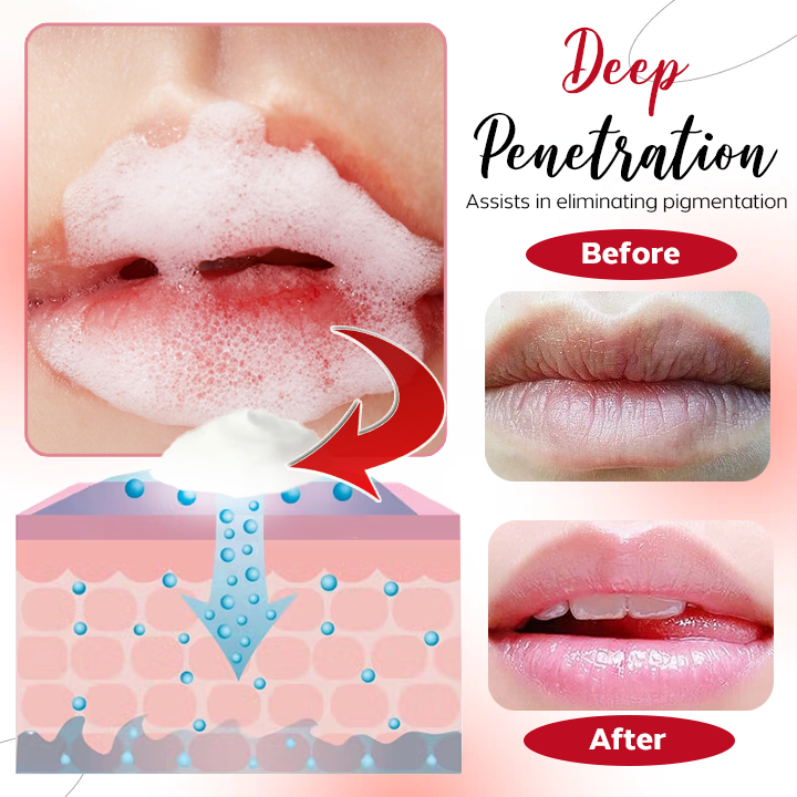 Oveallgo™ Dragons Blood Lip Rejuvenation Bubble Mask